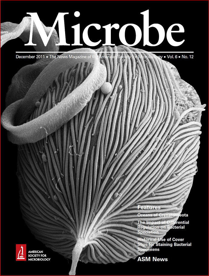 KJCarpenter_2011_MicrobeCover